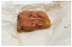 <Fig. 1>