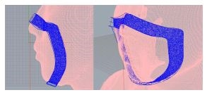 <Fig. 11>